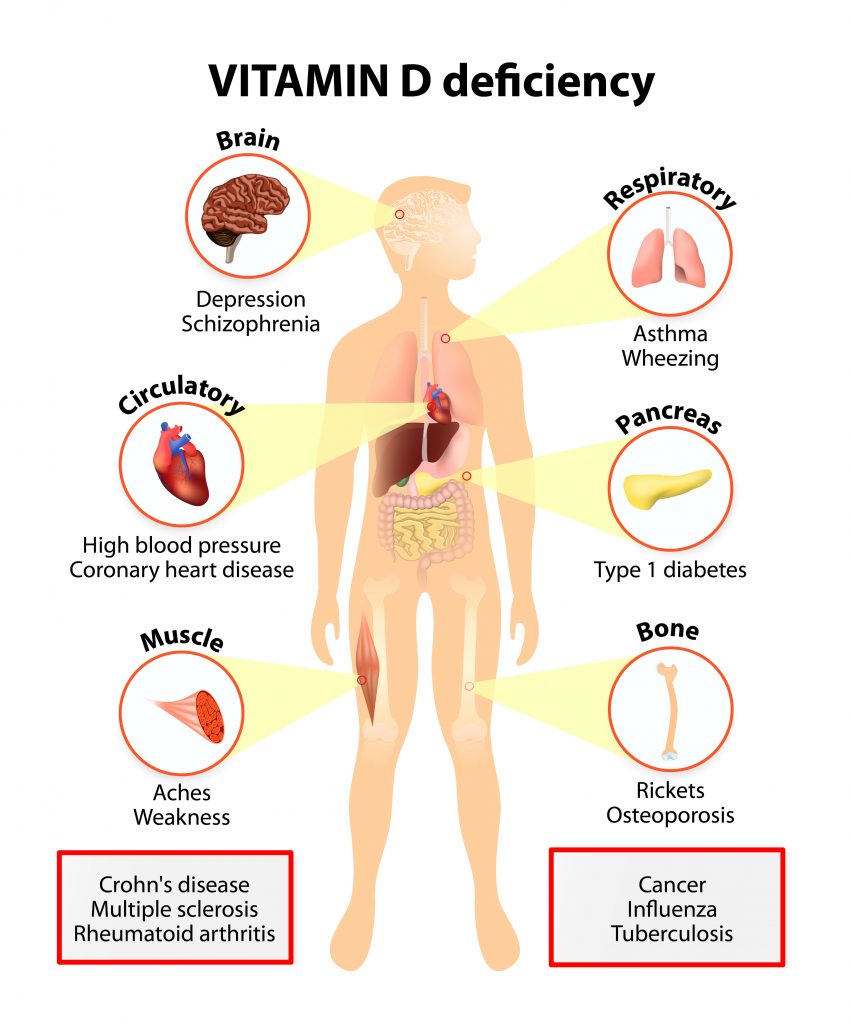 vitamin d deficiency symptoms