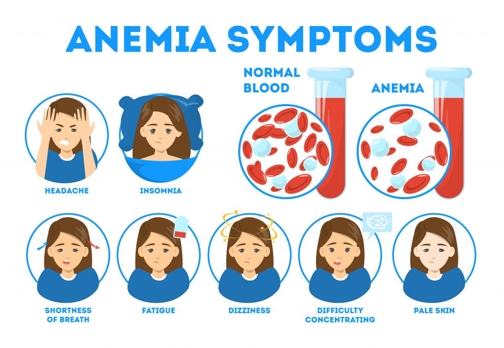 anaemia symptoms